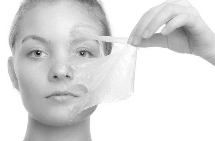 Peeling chimici